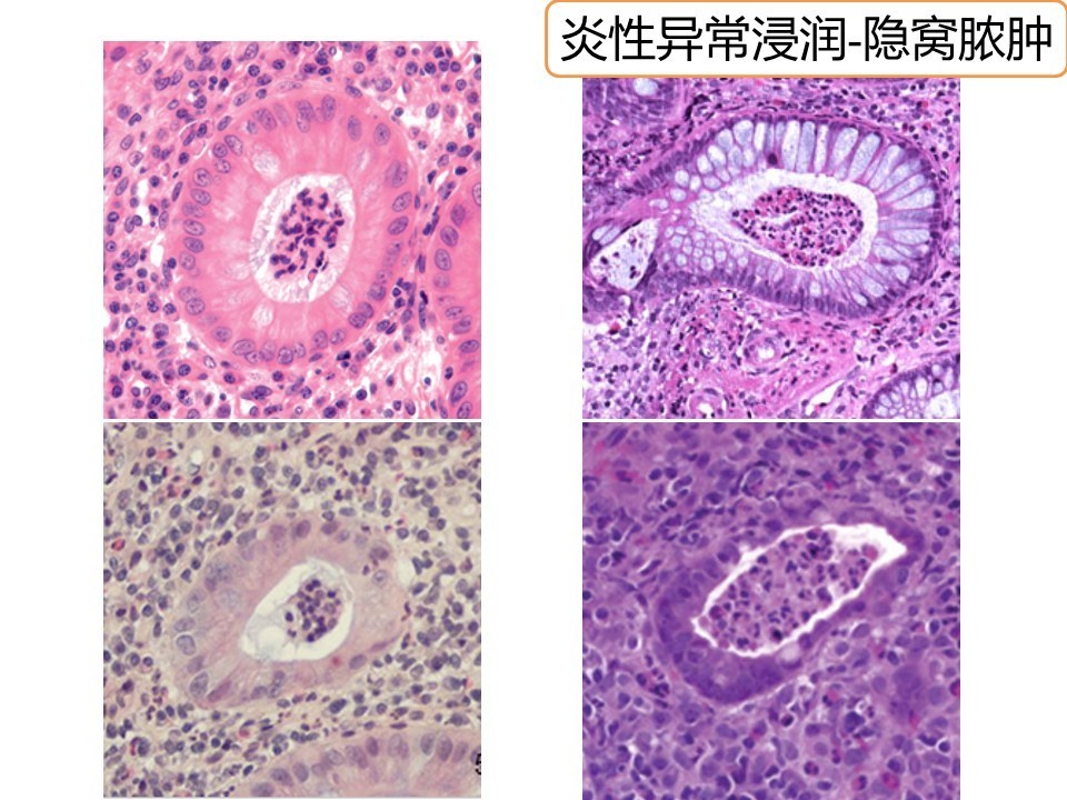 邮箱密码破解_邮箱破解密码工具_破解邮箱密码