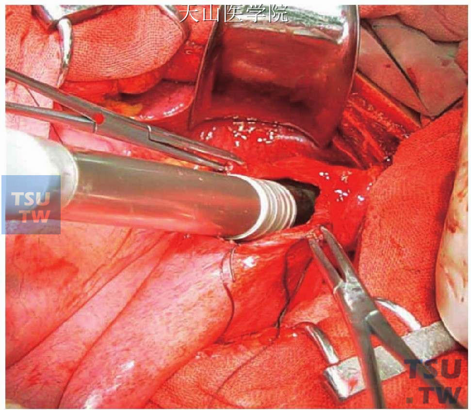 外科手术模拟2013_外科模拟手术下载_外科模拟手术室简介