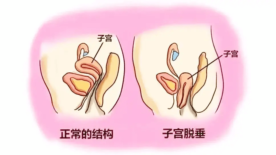 大脚更新不了_大脚更新器在哪_大脚更新后目标的目标没有了