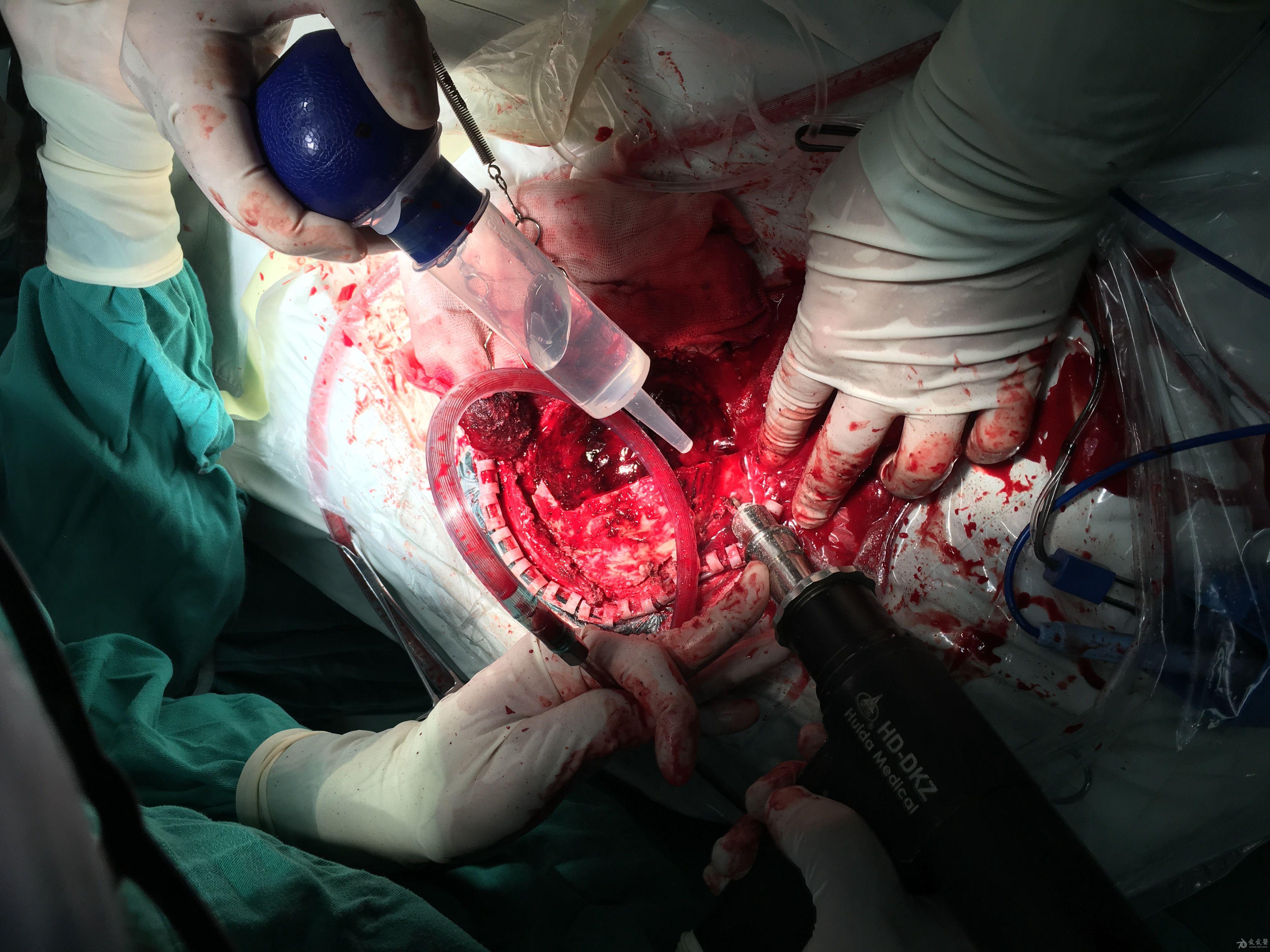外科模拟手术室简介_外科模拟手术下载_外科手术模拟2013