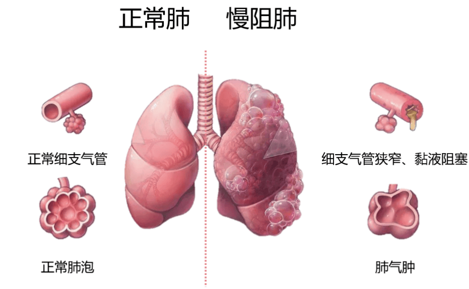 微软免费杀毒神器！MSE保护你的电脑安全