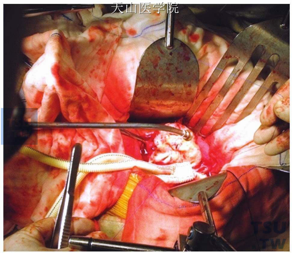 外科模拟手术下载_外科模拟手术室简介_外科手术模拟2013