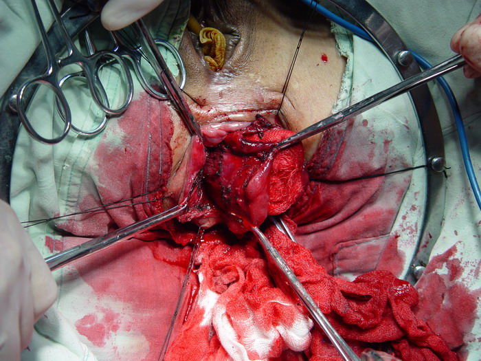 外科模拟手术室简介_外科手术模拟2013_外科模拟手术下载