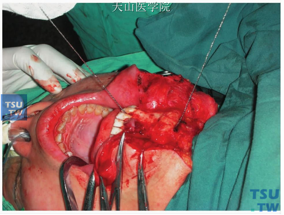 外科模拟手术下载_外科手术模拟2013_外科模拟手术室简介