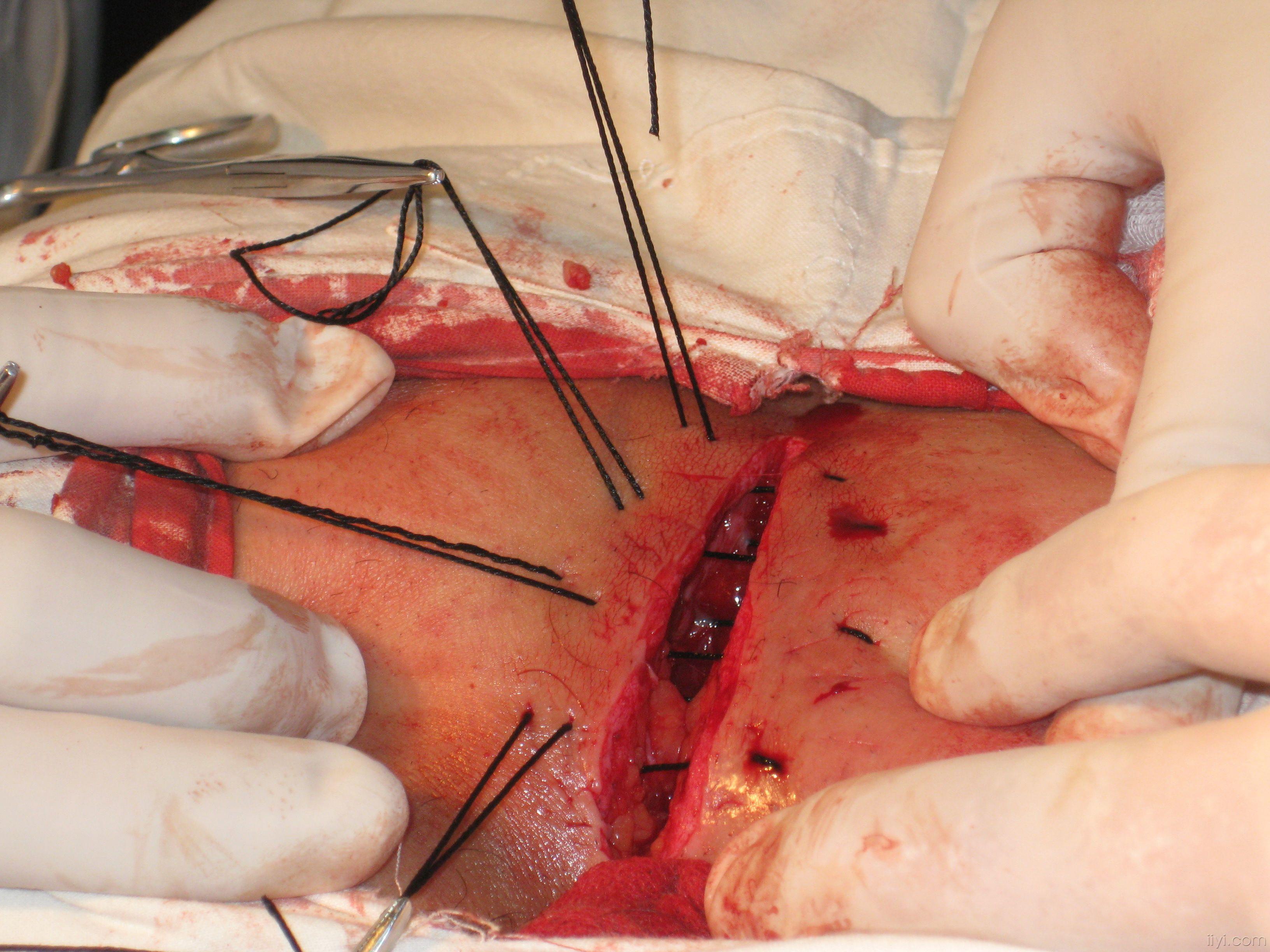 外科手术模拟2013_外科模拟手术室简介_外科模拟手术下载