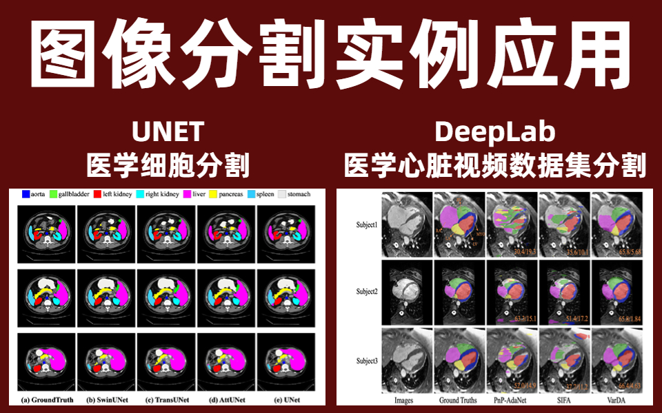 影子技能_影子打野_影子出装