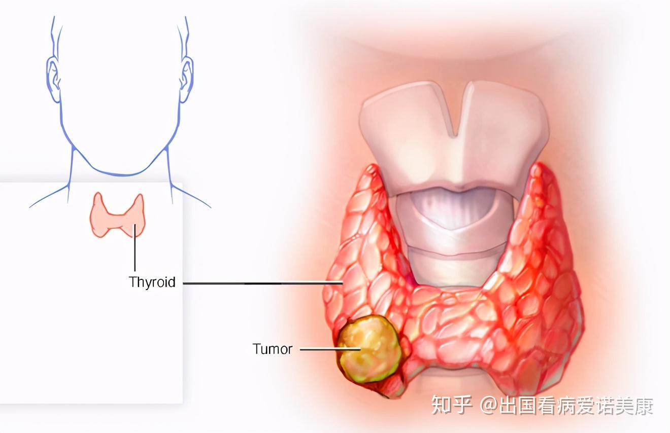 恺出装思路_恺出装顺序最强_恺出装