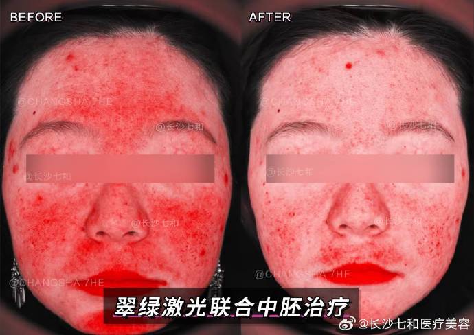 梦三曹洪出装_梦三国曹洪出装三国志_曹洪娱乐出装